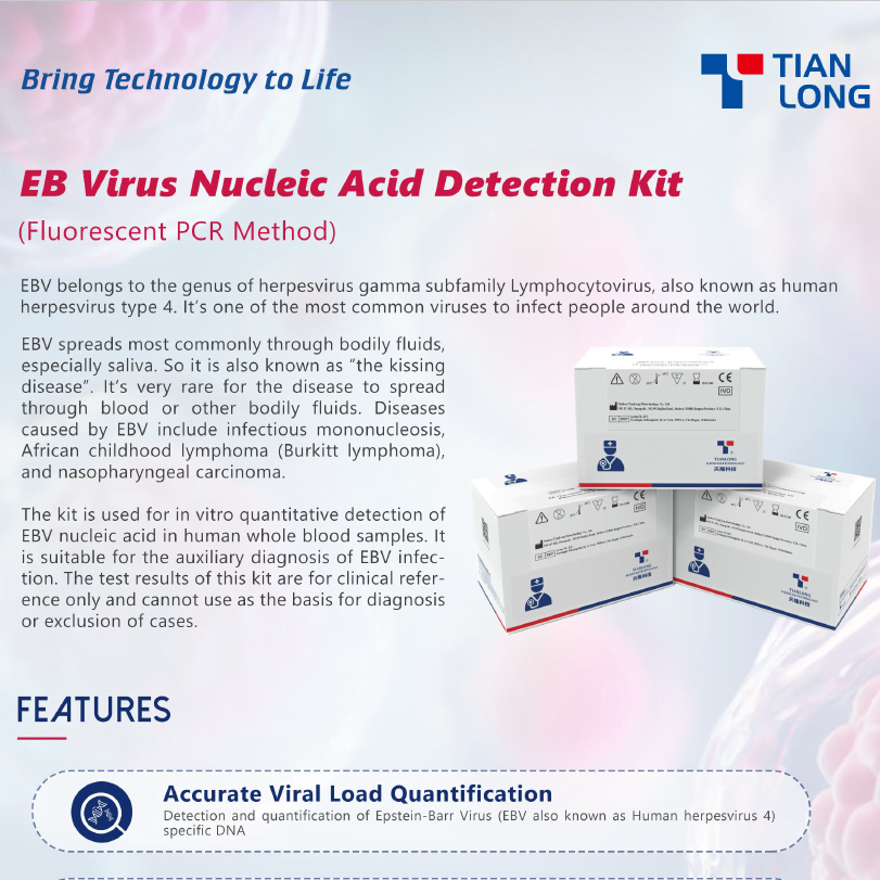 Bộ kit phát hiện axit nucleic của virus EB – EBV – Bệnh bạch cầu đơn nhân